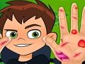 Mchezo Daktari wa mkono wa Ben10  online