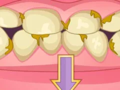 Mchezo Bad Teeth Makeover online