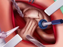 Mchezo Princess Hips Surgery online