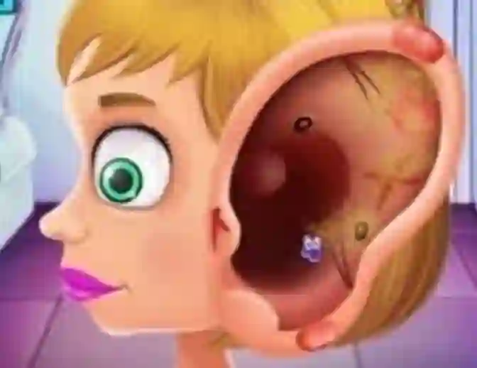 Mchezo Children's Doctor Treating Ears online