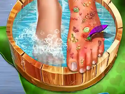 Mchezo Feet Skin Doctor online