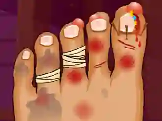 Mchezo Monster Foot Doctor online