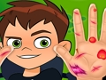 Mchezo Daktari wa mkono wa Ben10  online